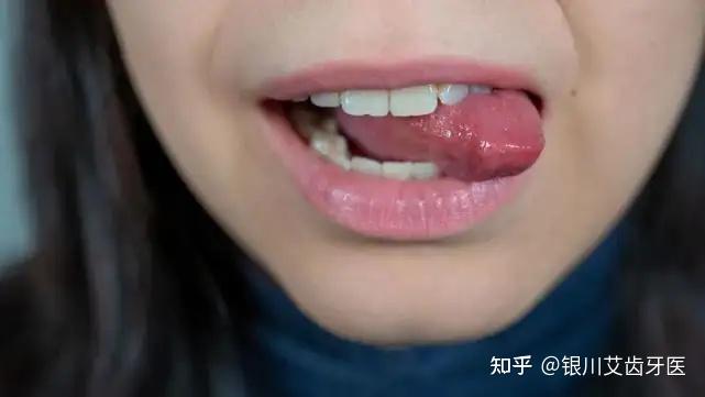 舌头在口腔里的摆放和牙齿外突的关系