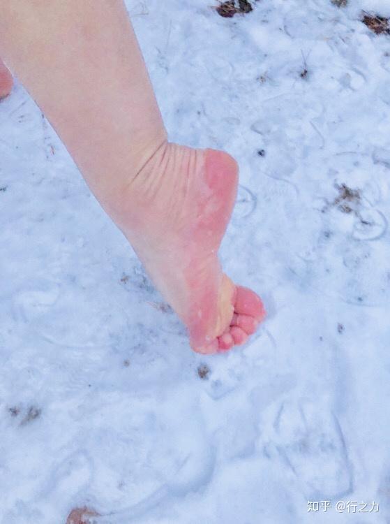 赤脚走雪地脚冻成冰图片