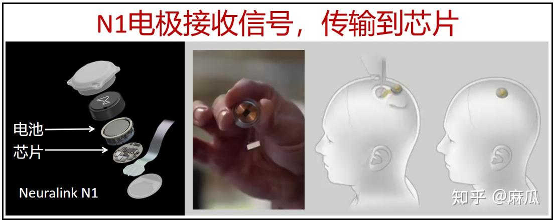 马斯克称 Neuralink 完成首例人类脑机接口设备植入，志愿者目前恢复良好，如何评价这一技术？ - 知乎