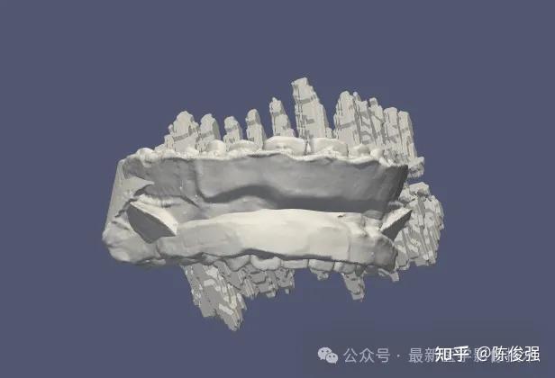 STSR2025——CBCT牙齿分割和CBCT与IOS注册配准 - 知乎